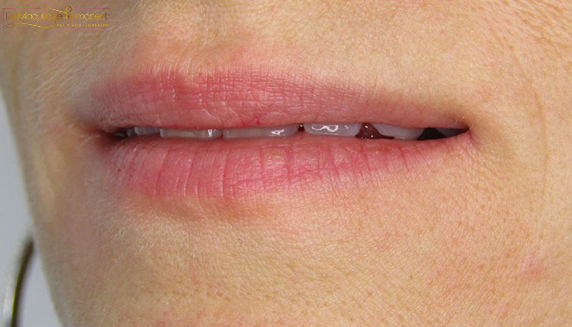Le maquillage permanent des lèvres — avant